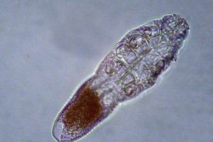 Your Face Is A Home To Millions Of Mites! Don’t Freak Out – Read The Facts Below!